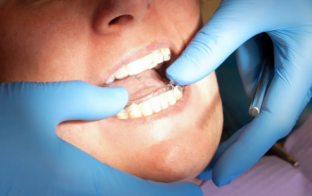 Bellesa Tractaments Estètics – Clínica Gironella & Maynau