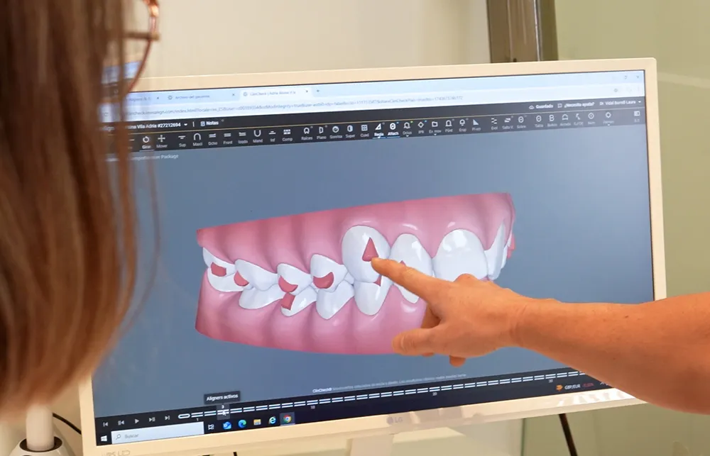 Bellesa Tractaments Estètics – Clínica Gironella & Maynau